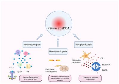 Pain in axial spondyloarthritis: role of the JAK/STAT pathway